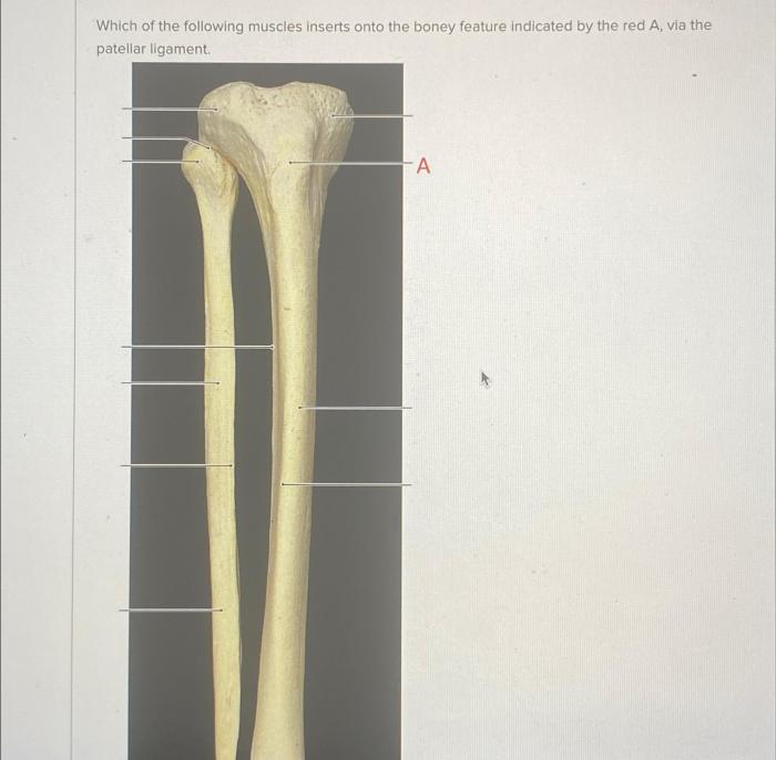 Which of the following muscles inserts on the highlighted structure